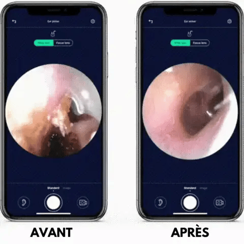 NetCam EAR - outil de nettoyage des oreilles avec camera intégré. HM