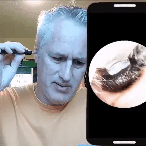 NetCam EAR - outil de nettoyage des oreilles avec camera intégré. HM